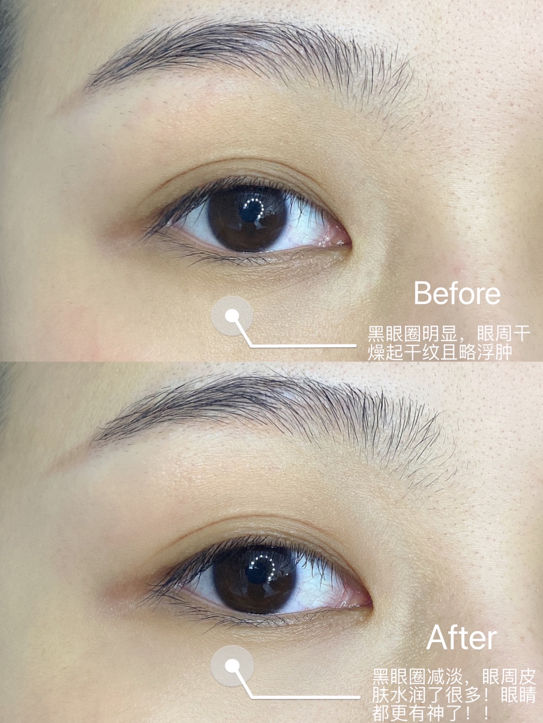 眼霜—Kerrykerry宝贝收到了，，，刚用肌肤嘟噜嘟噜的喝水，，用完之后脸明显变白了，，很喜欢